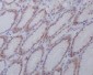 Anti-active + pro Caspase 3 CASP3 Rabbit Monoclonal Antibody